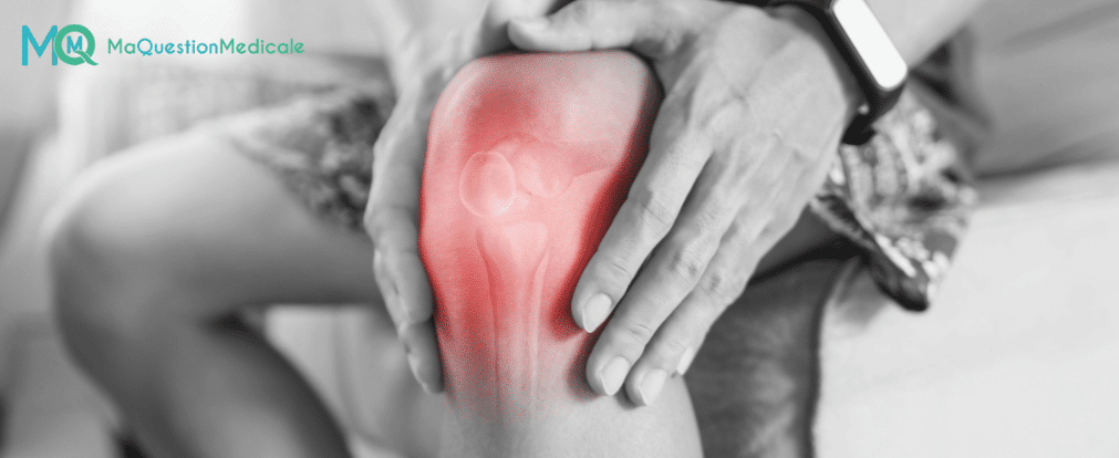 Arthrite