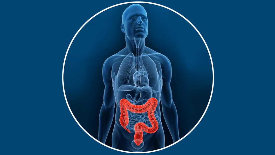 Cancers digestifs -foto