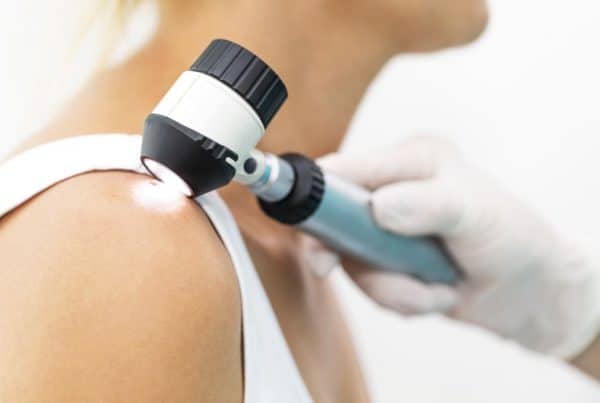 Lésions de la peau comment fonctionne la télé-dermatologie en pharmacie - foto