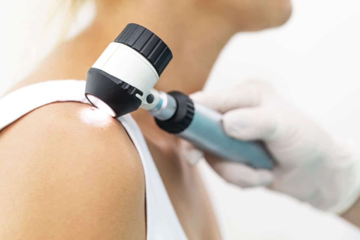 Lésions de la peau comment fonctionne la télé-dermatologie en pharmacie - foto